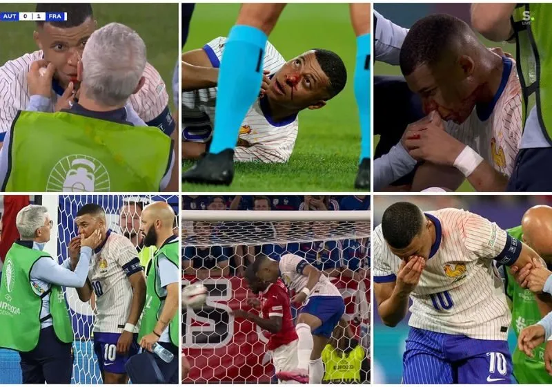 chấn thương của mbappe
