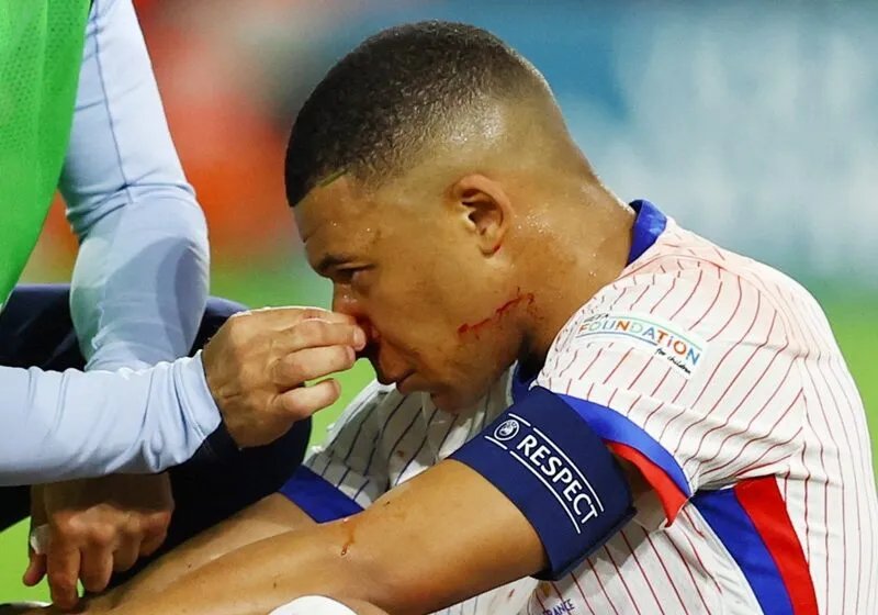 mat-na-mbappe