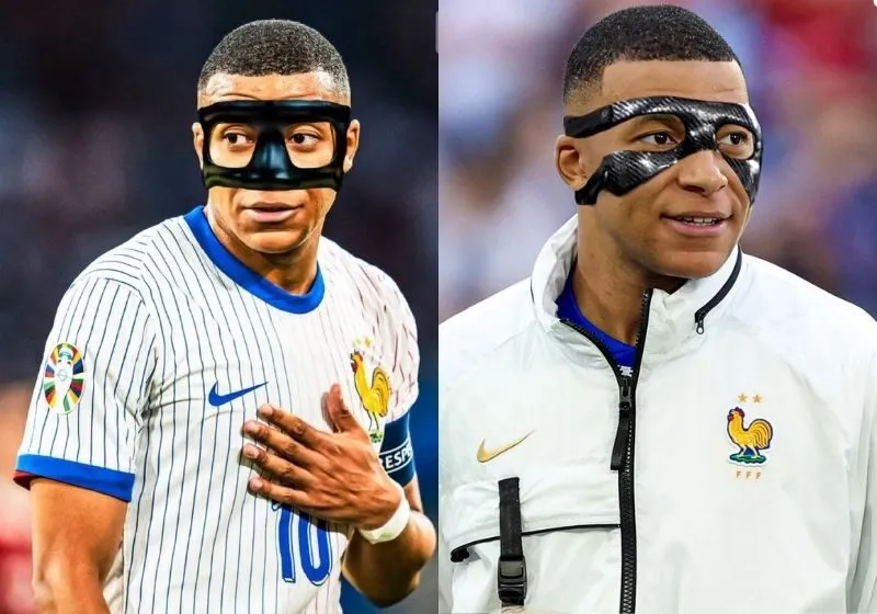 mbappe vỡ mũi
